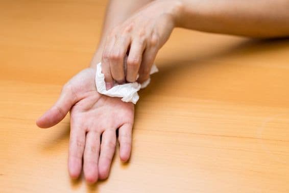 Femme souffrant de mains moites.